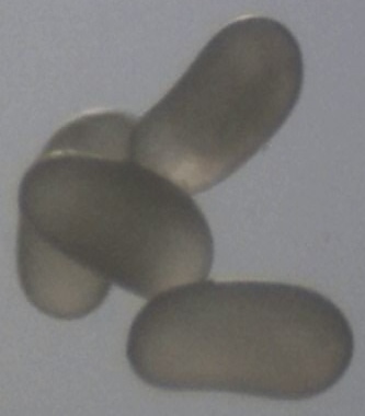 Eierhaufen Myrmica2.jpg