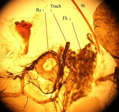 5-Spermasack_steven_2 tx web.jpg