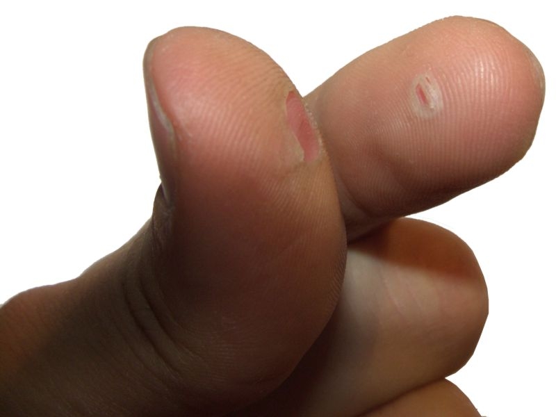 Ameisensäure bei Polyrhachis dives